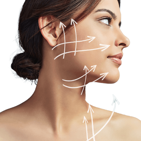 Procedimientos quirúrgicos: Face y neck lift