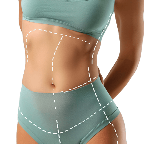 Procedimientos quirúrgicos: Mommy make over